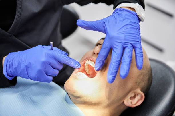 Best Broken or Chipped Tooth Repair in Nocatee, FL
